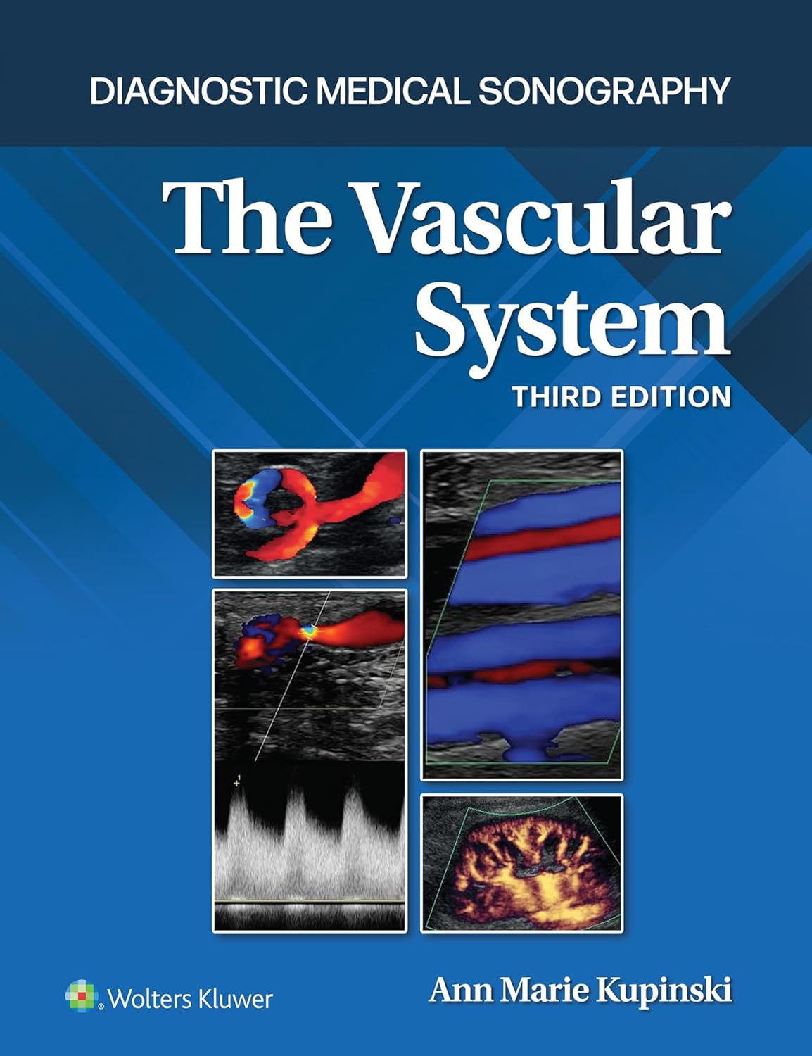 The Vascular System (Diagnostic Medical Sonography Series), 3rd Edition  by Ann Marie Kupinski