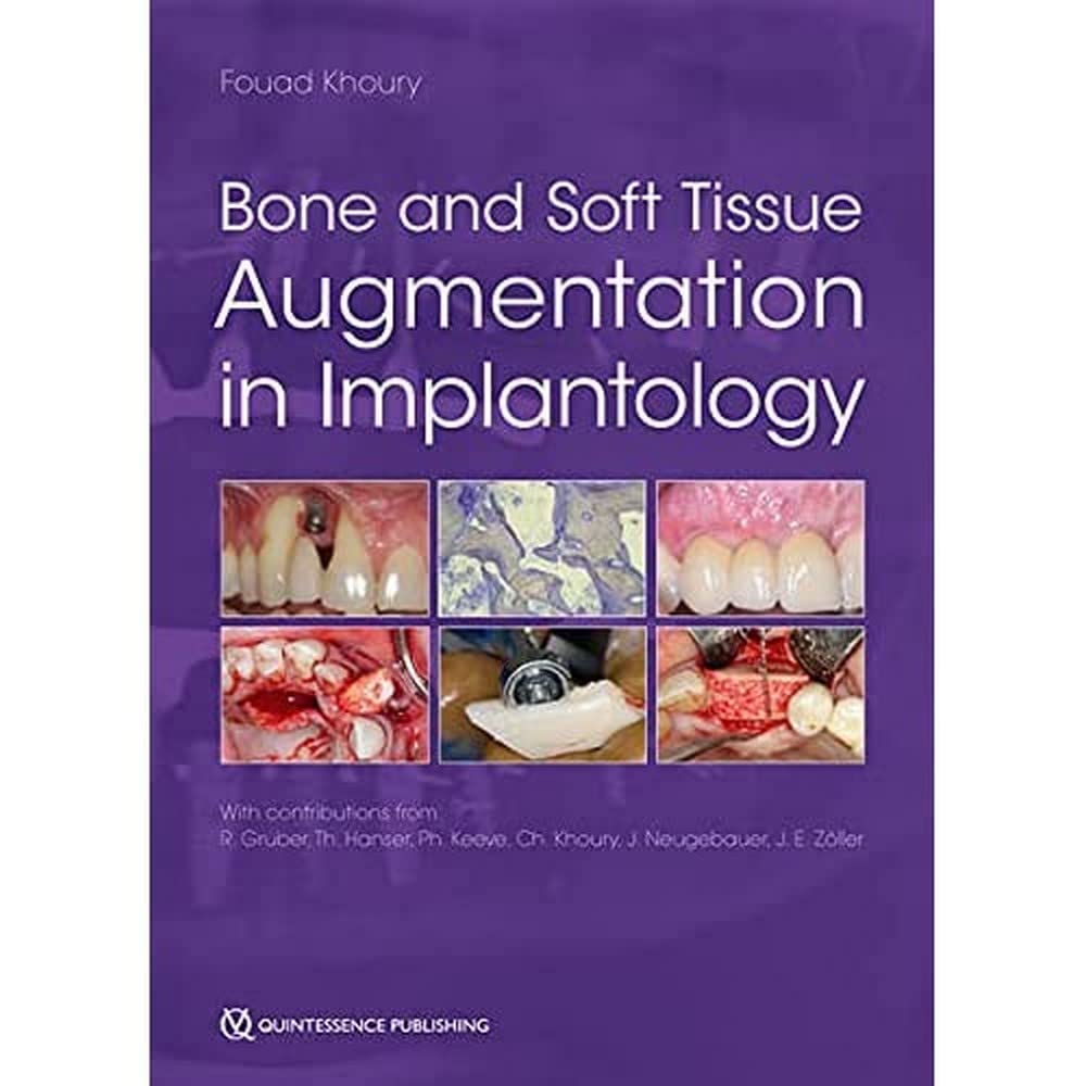 Bone and Soft Tissue Augmentation in Implantology  by Fouad Khoury 