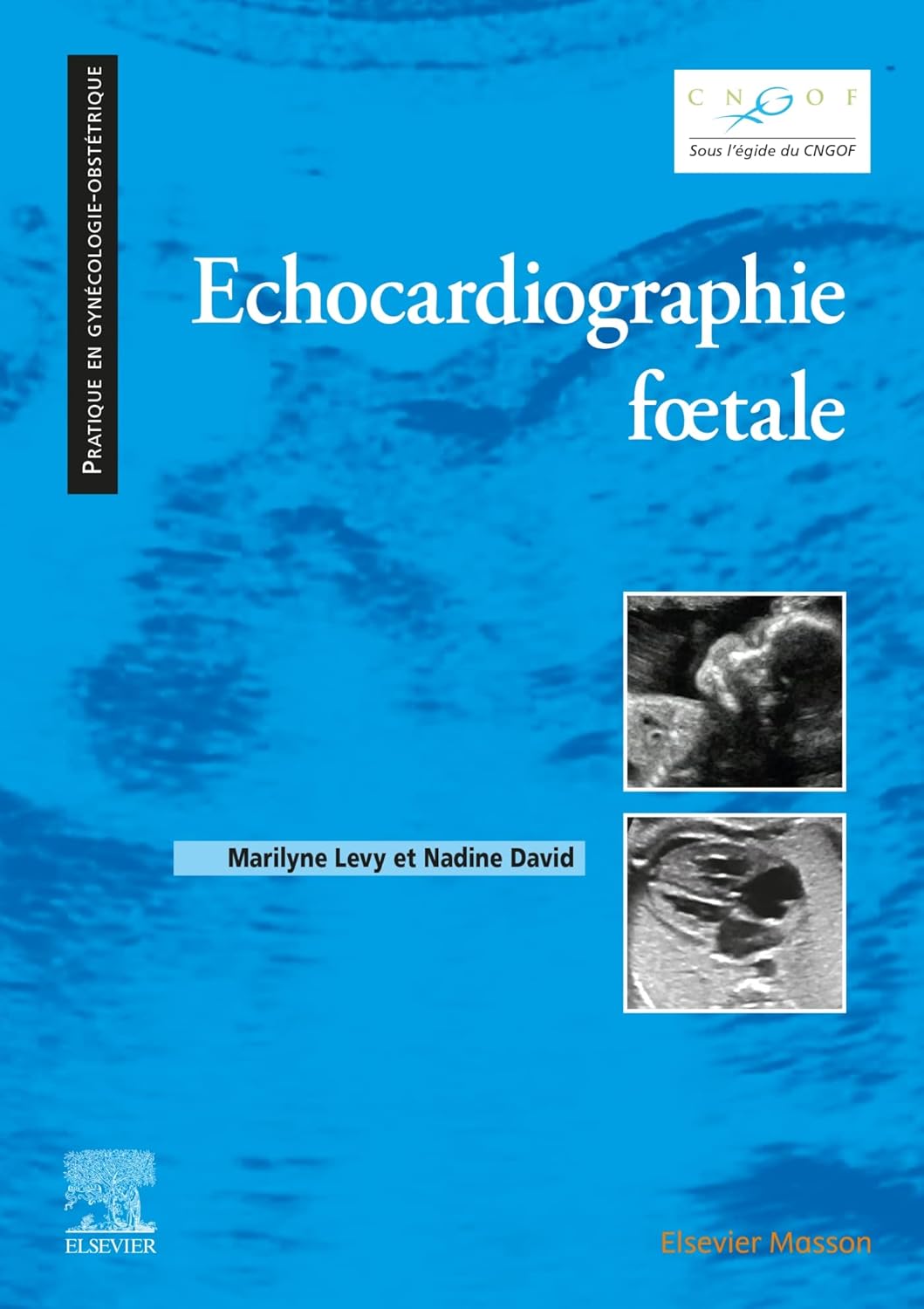 Echocardiographie foetale by  Maryline L＆eacute;vy