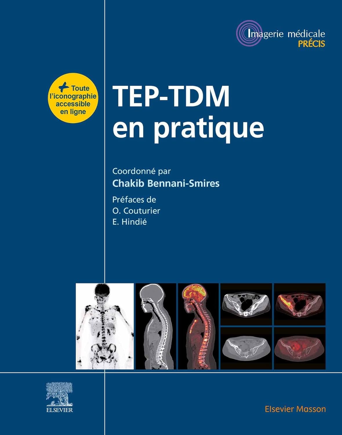 TEP-TDM en pratique  by Chakib Bennani Smires 