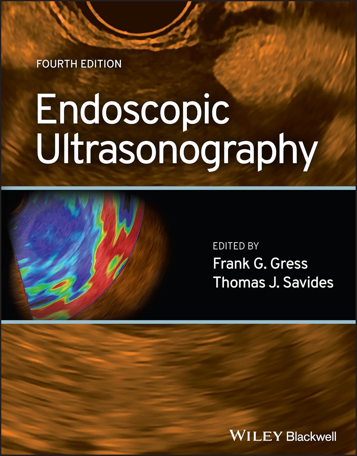 (EBook PDF)Endoscopic Ultrasonography, 4th Edition by Frank G. Gress, Thomas J. Savides