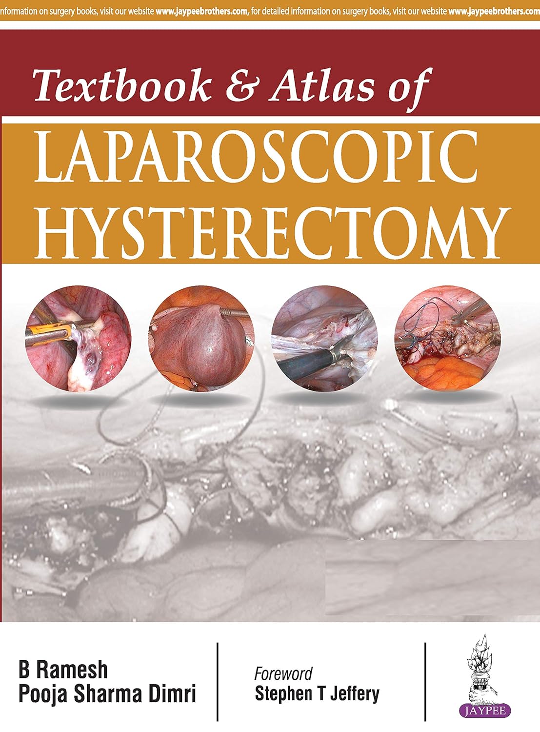 Textbook and Atlas of Laparoscopic Hysterectomy  by  B Ramesh 