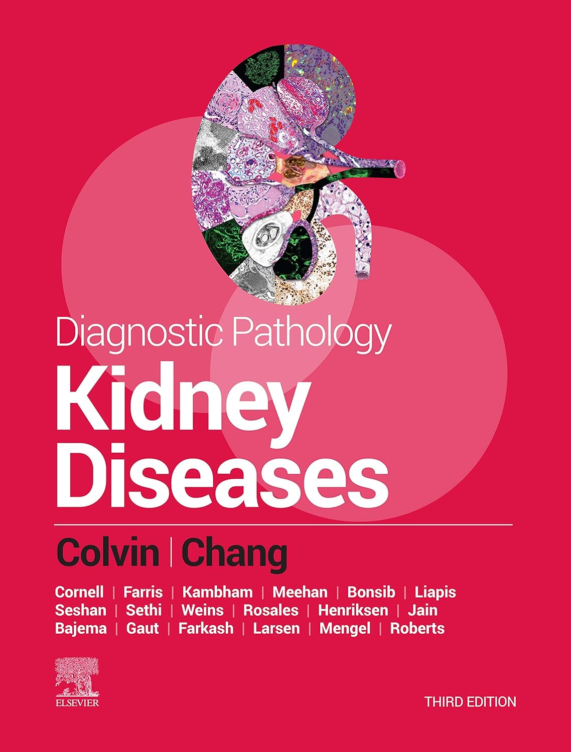 Diagnostic Pathology: Kidney Diseases, 3rd Edition by Robert B. Colvin