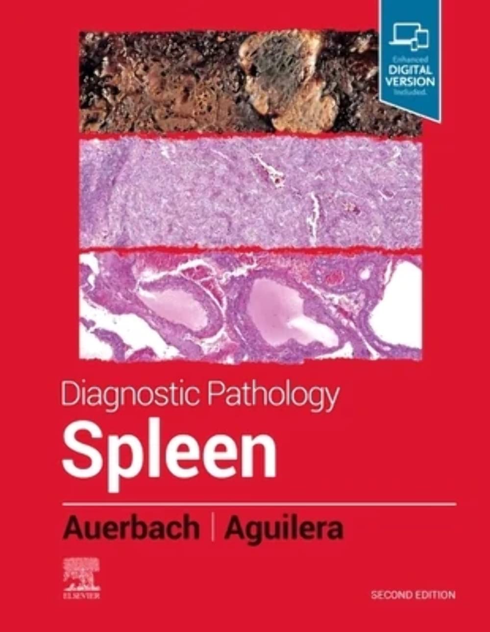 Diagnostic Pathology: Spleen, 2nd Edition by Aaron Auerbach MD MPH 