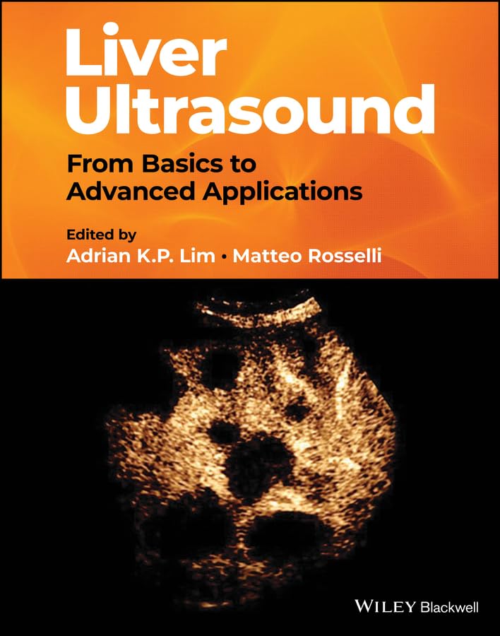 (EBook PDF)Liver Ultrasound: From_ Basics to Advanced Applications by Adrian K. P. Lim, Matteo Rosselli