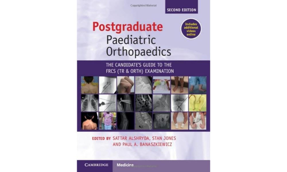 (EBook PDF)Postgraduate Paediatric Orthopaedics: The Candidate s Guide to the FRCS(Tr＆amp;Orth) Examination 2e by  Sattar Alshryda, Stan Jones, Paul A. Banaszkiewicz