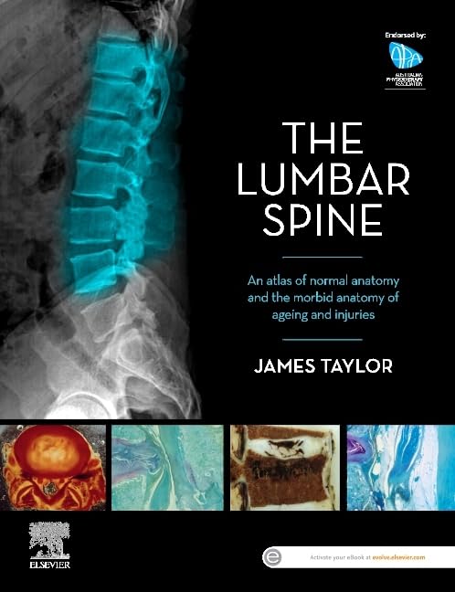 The Lumbar Spine: An Atlas of Normal Anatomy and the Morbid Anatomy of Ageing and Injury by James Taylor