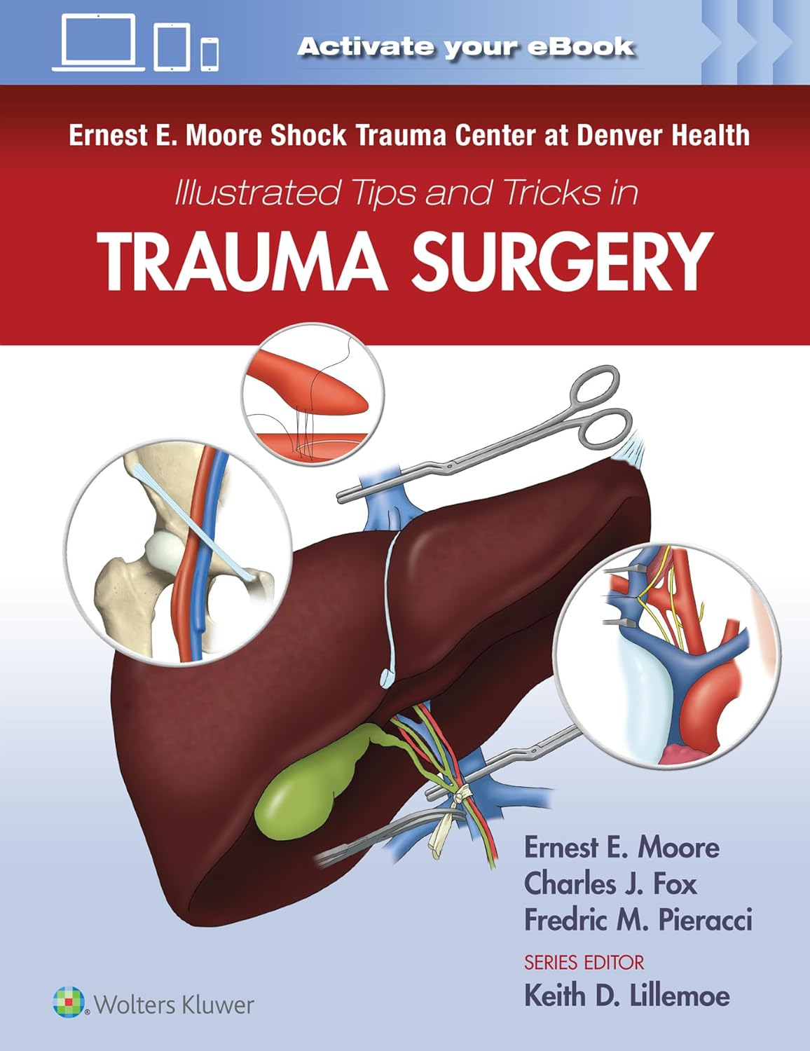 (EBook PDF)Ernest E. Moore Shock Trauma Center at Denver Health Illustrated Tips and Tricks in Trauma Surgery by LWW; First Edition (December 9, 2022)