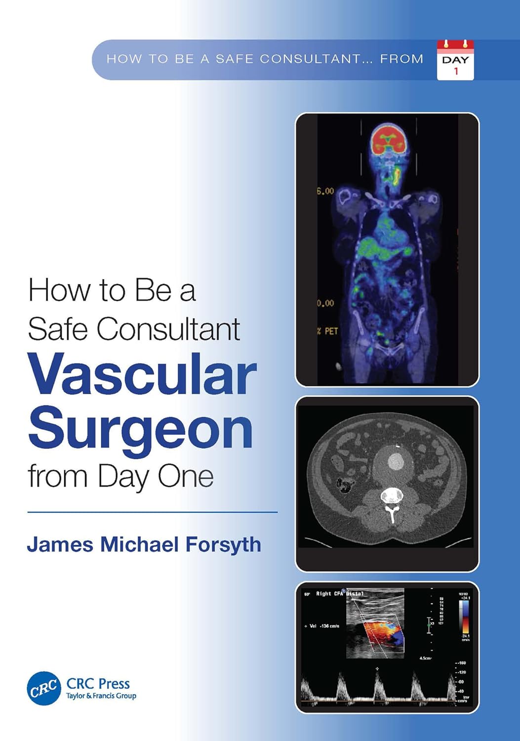 How to Be a Safe Consultant Vascular Surgeon from_Day One by James Forsyth 