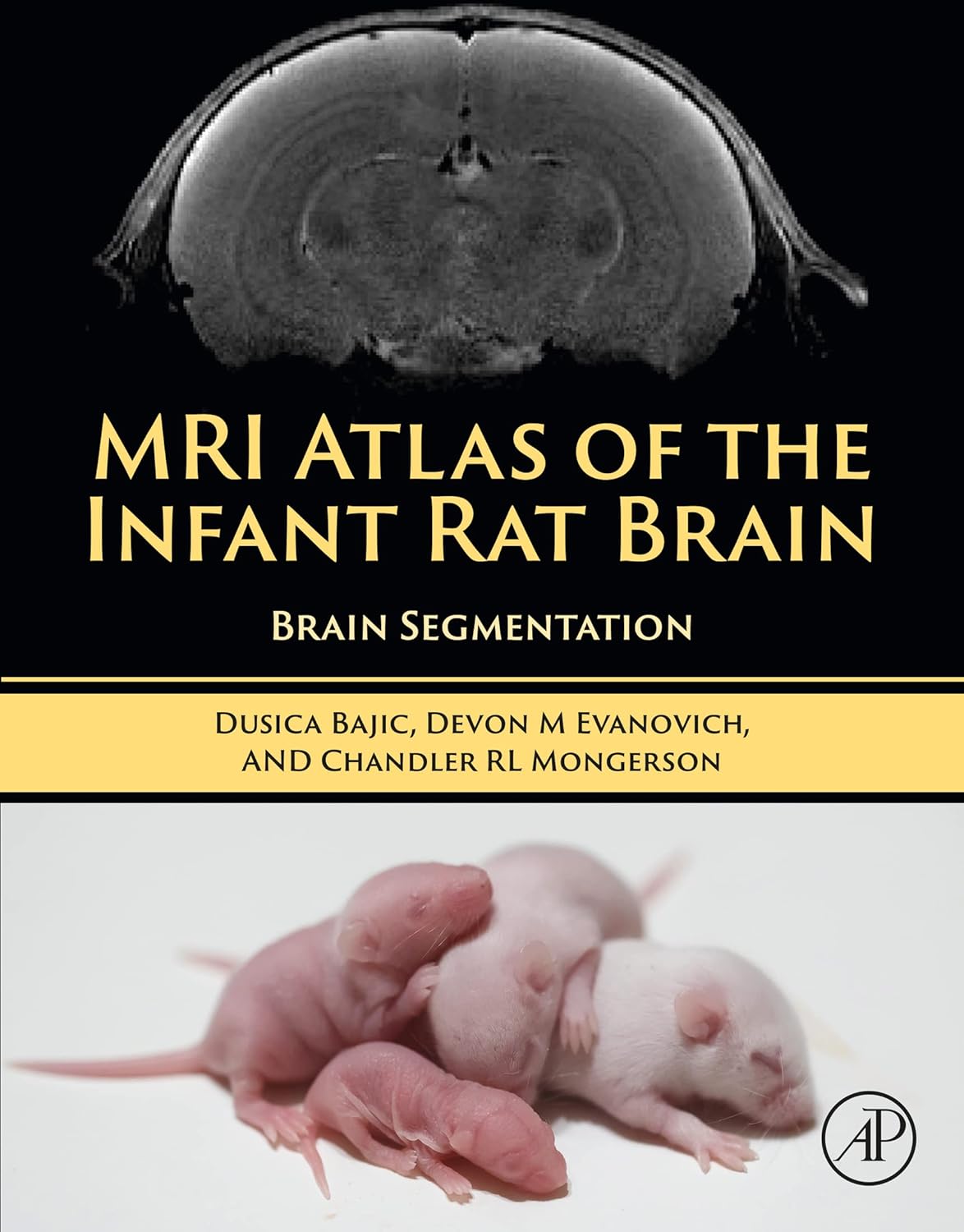 MRI Atlas of the Infant Rat Brain: Brain Segmentation by Dusica Bajic