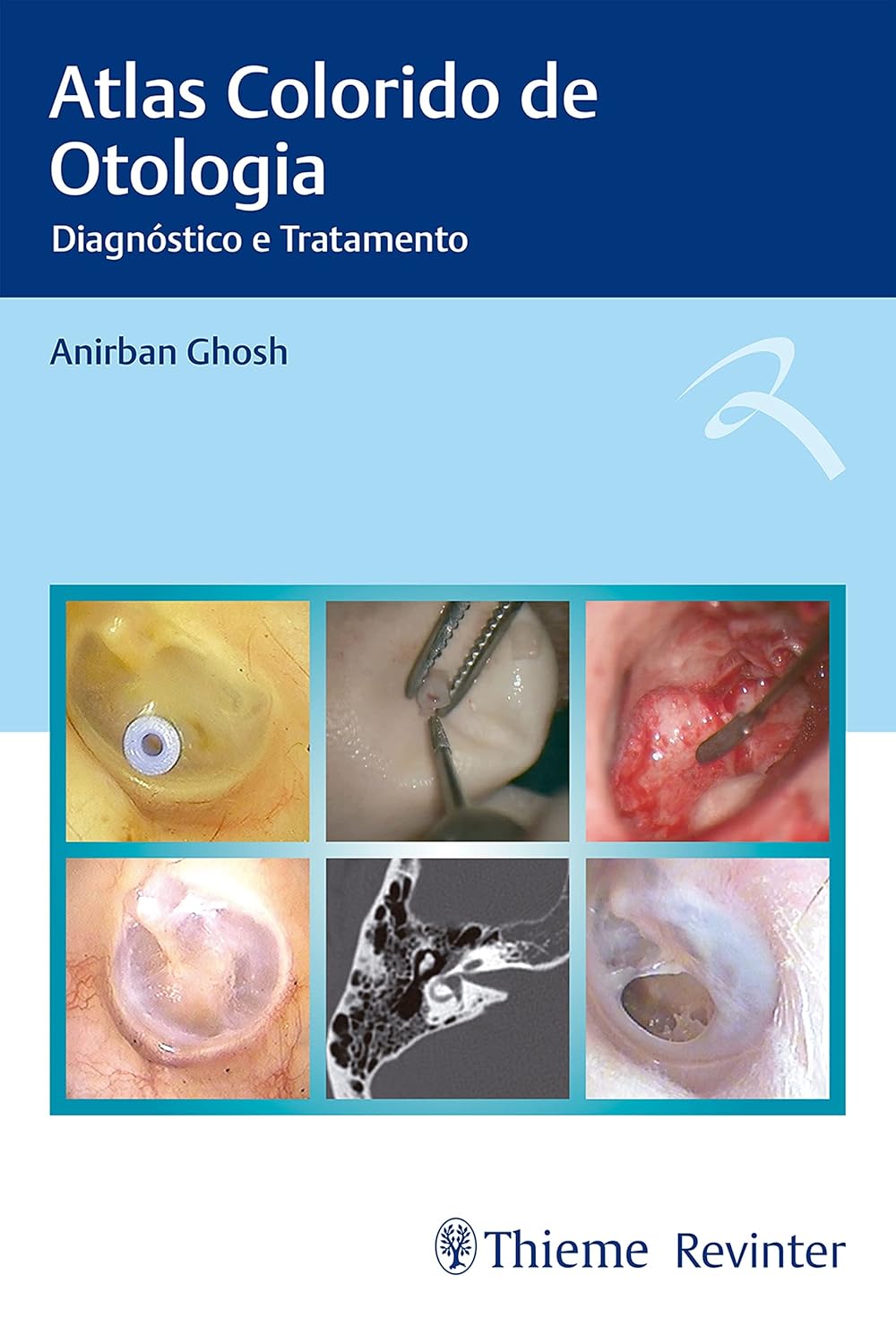 (EBook PDF)Atlas Colorido de Otologia: Diagn＆oacute;stico e Tratamento by Anirban Ghosh