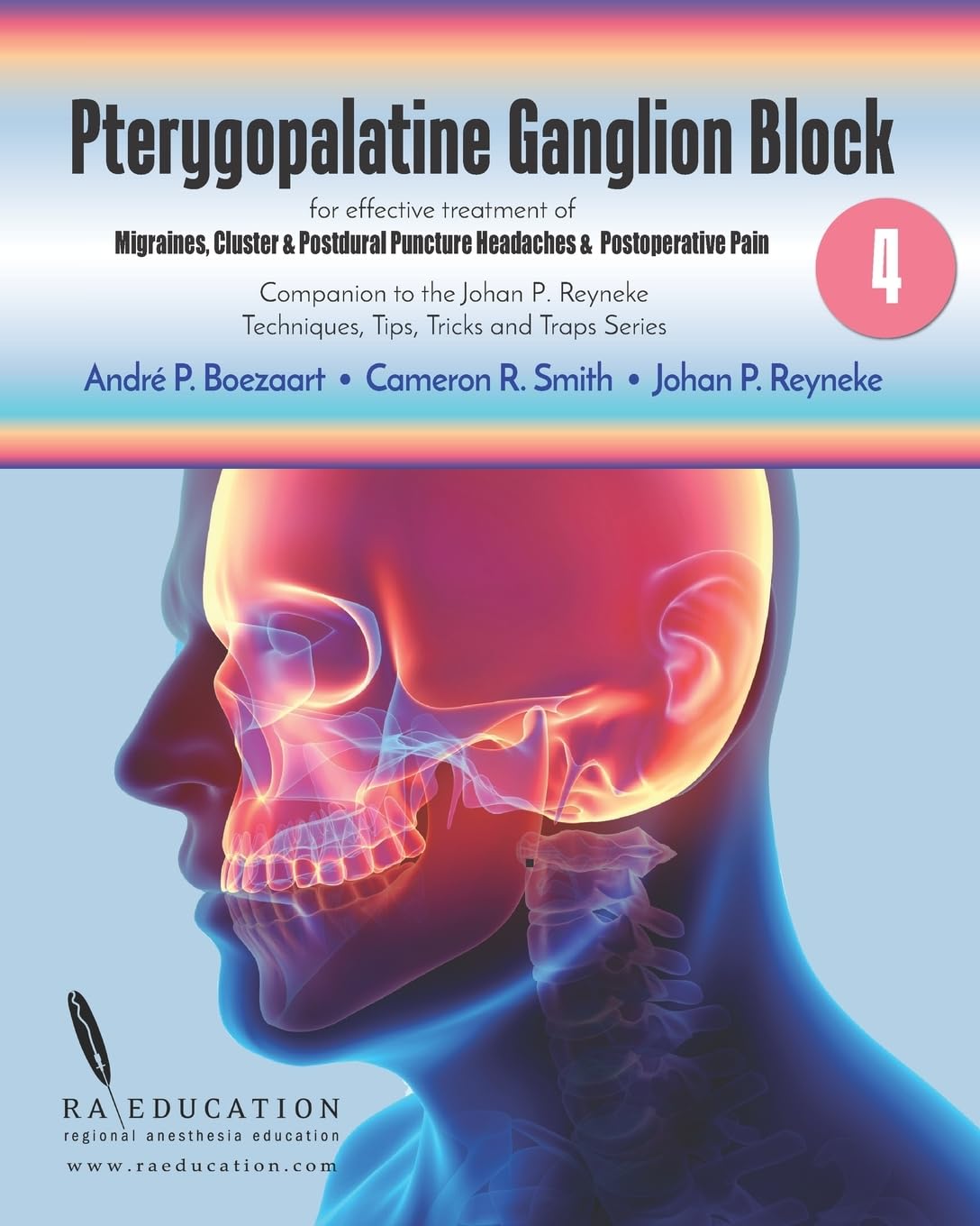 Johan P Reyneke s Techniques, Tips, Tricks ＆amp; Traps Vol 4:: Pterygopalatine Ganglion Block by Andre P Boezaart