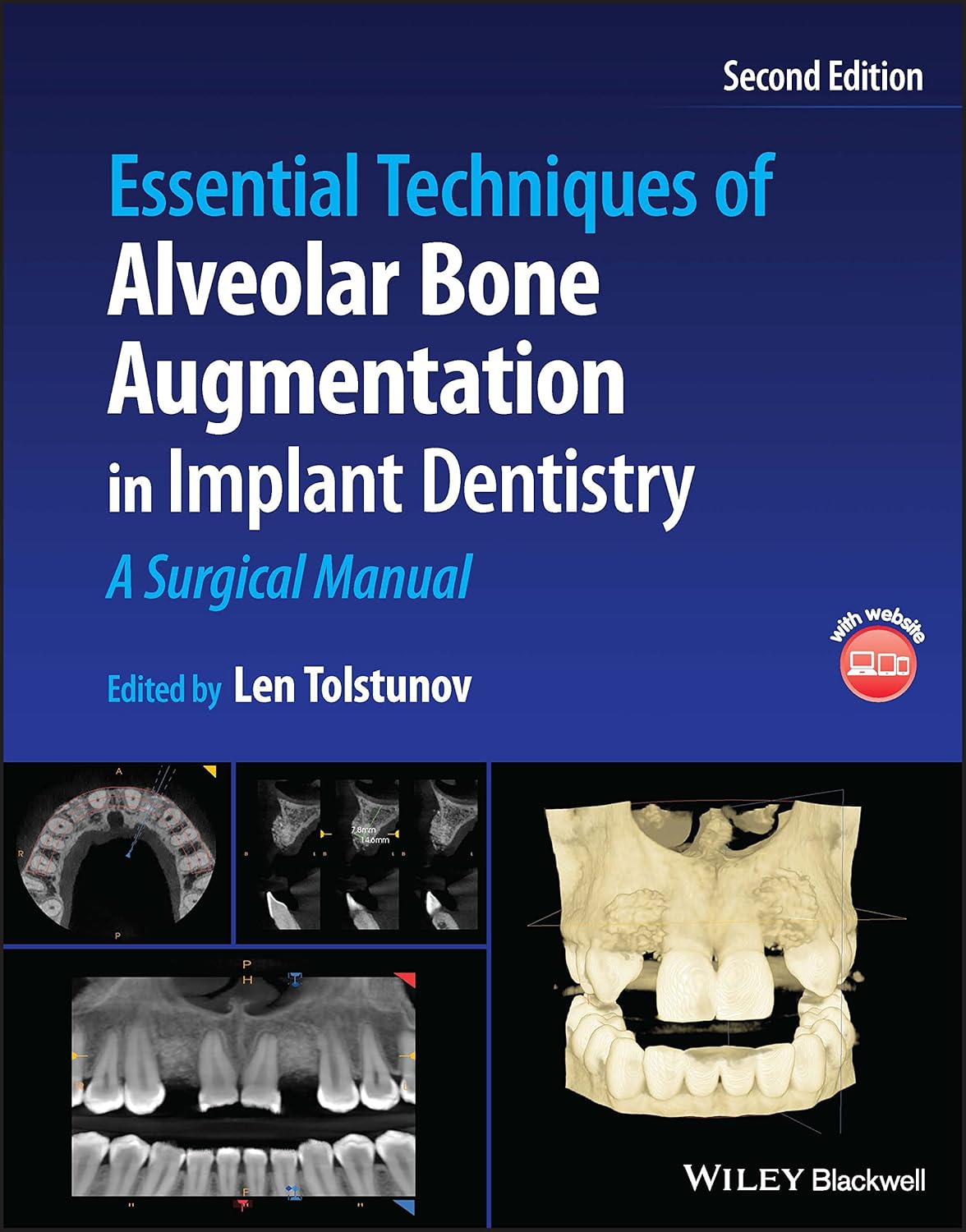 Essential Techniques of Alveolar Bone Augmentation in Implant Dentistry: A Surgical Manual, 2nd Edition by Len Tolstunov