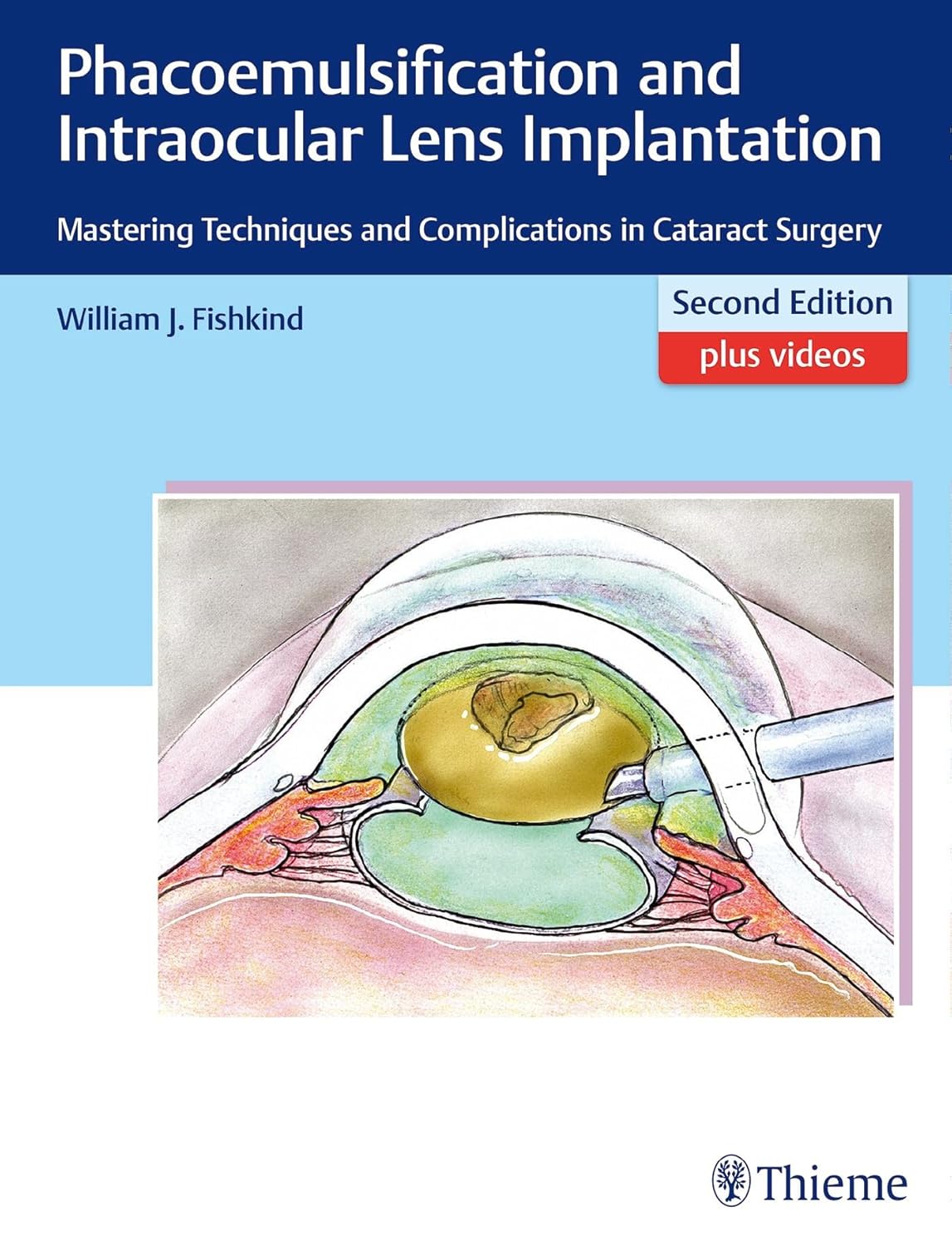 Phacoemulsification and Intraocular Lens Implantation: Mastering Techniques and Complications in Cataract Surgery, 2nd Edition  by William J. Fishkind 