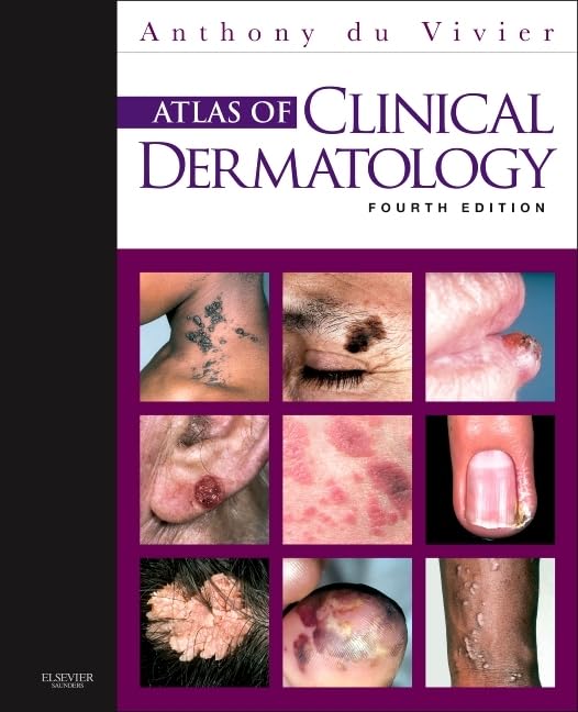 (EBook PDF)Atlas of Clinical Dermatology 4th Edition by Anthony du Vivier MD FRCP