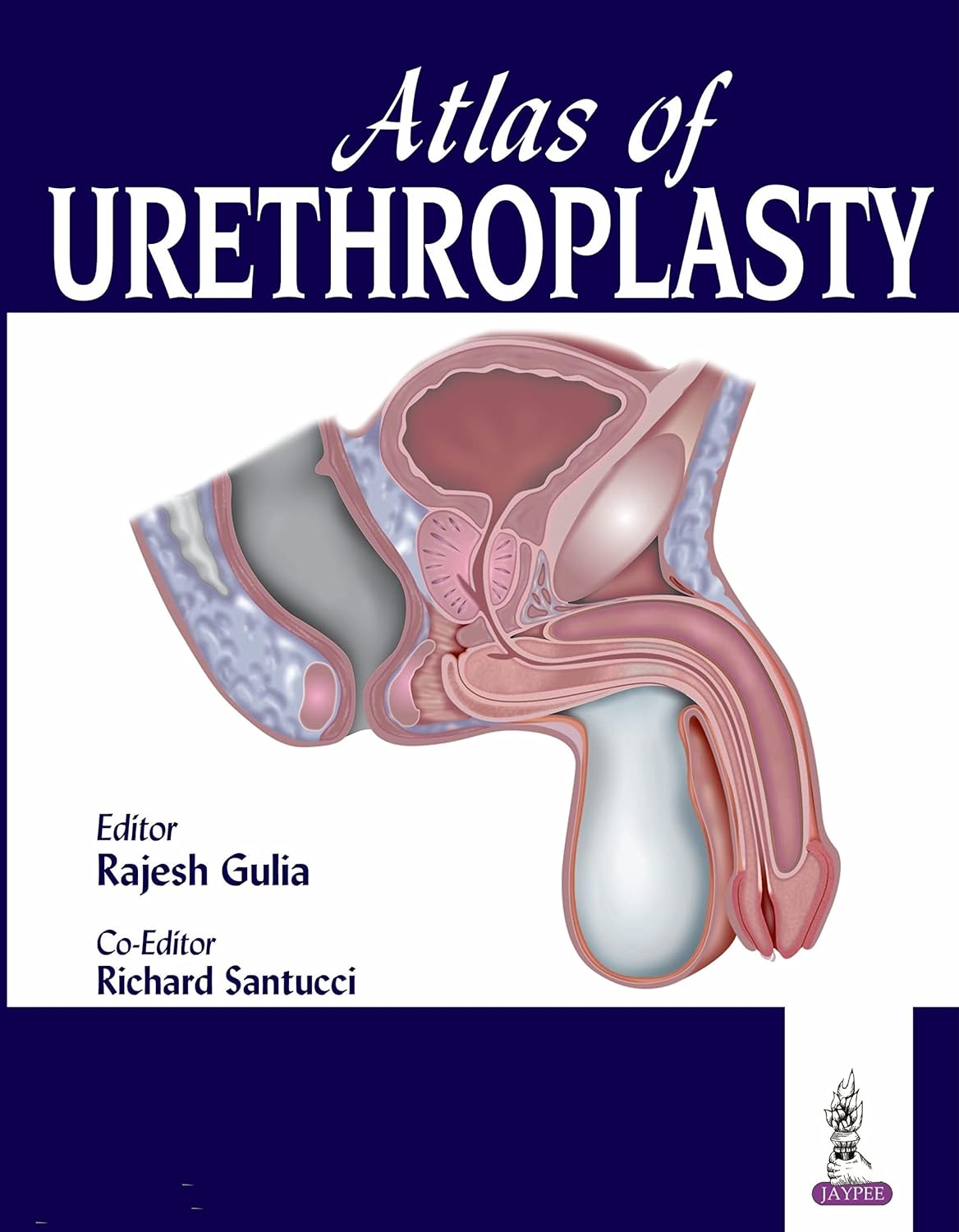 (EBook PDF)Atlas of Urethroplasty by Rajesh Gulia, Richard A. Santucci, Sanjay B. Kulkarni