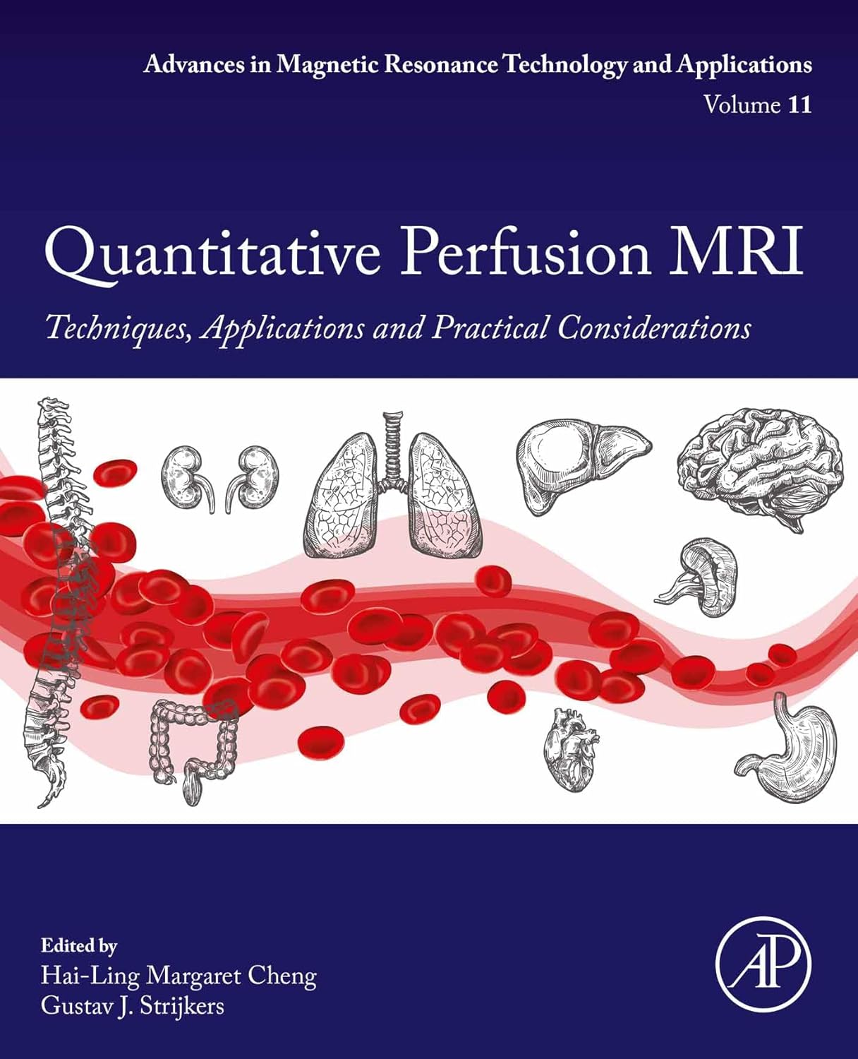 (EBook PDF)Quantitative Perfusion MRI: Techniques, Applications and Practical Considerations by Hai-Ling Margaret Cheng, ‪Gustav J. Strijkers‬