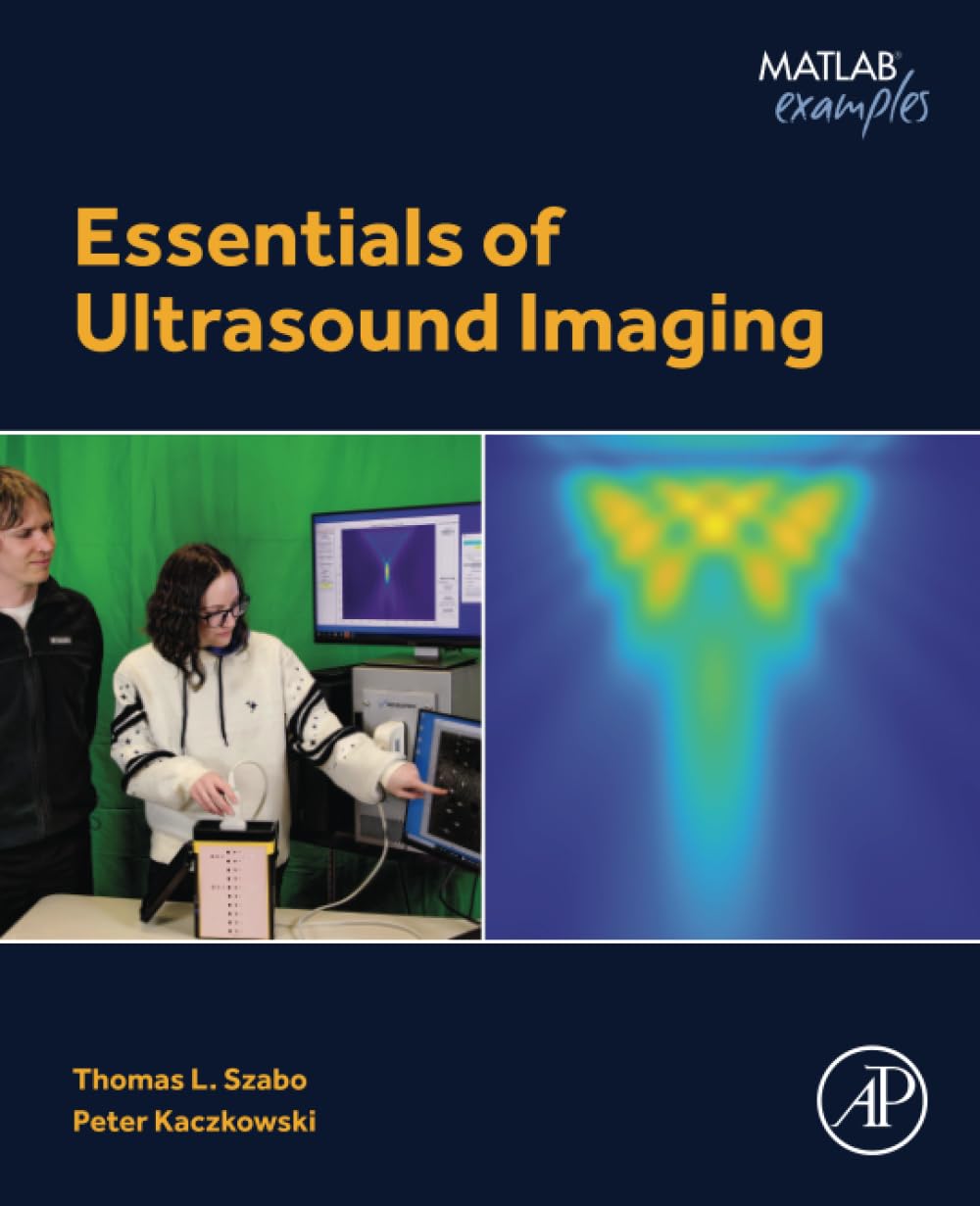 (EBook PDF)Essentials of Ultrasound Imaging by Thomas L. Szabo, Peter Kaczkowski