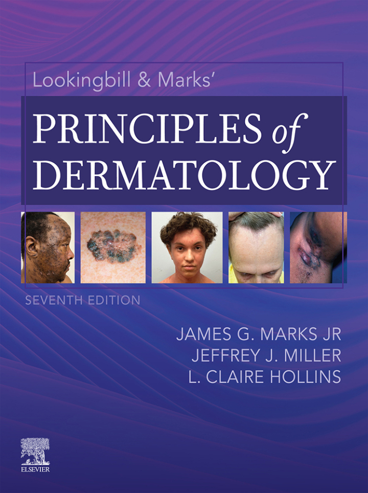 (eBook PDF)Lookingbill & Marks  Principles of Dermatology 7th Edition by James G. Marks