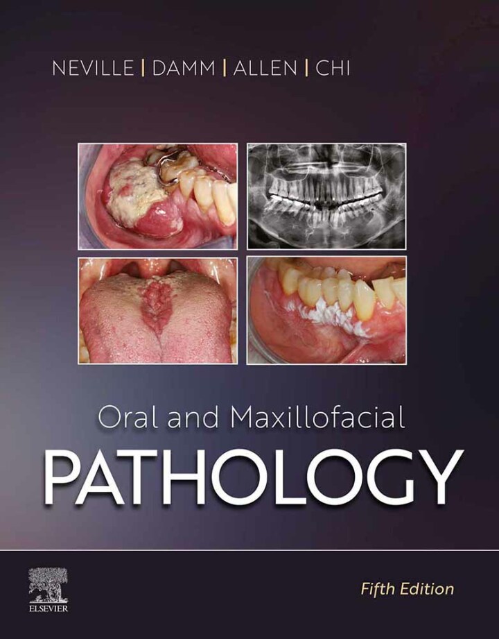 (eBook PDF)Oral and Maxillofacial Pathology 5th Edition by  Brad W. Neville;