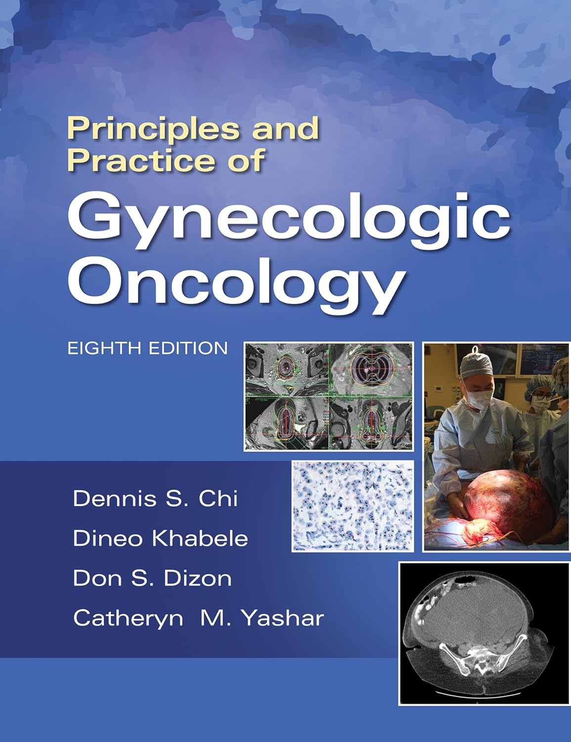 Principles and Practice of Gynecologic Oncology, 8th Edition by Dennis Chi 