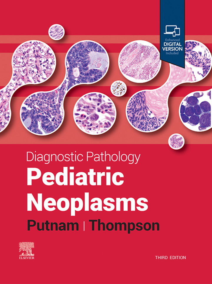 Diagnostic Pathology: Pediatric Neoplasms, 3rd edition  by  Angelica R. Putnam