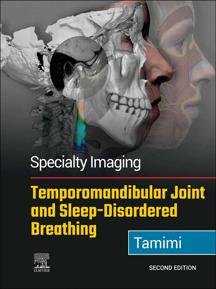 Specialty Imaging: Temporomandibular Joint and Sleep-Disordered Breathing, 2nd edition (Original PDF) by Dania Tamimi