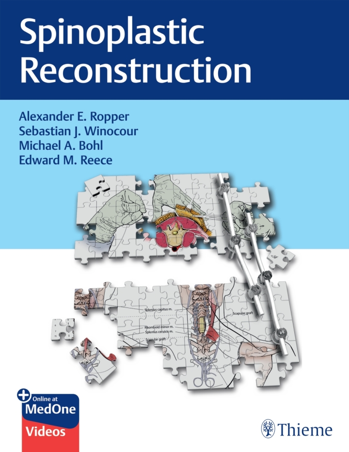 Spinoplastic Reconstruction 1st Edition by Alexander E. Ropper