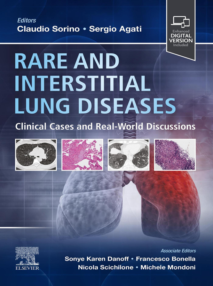 Rare and Interstitial Lung Diseases: Clinical Cases and Real-World Discussions by Claudio Sorino