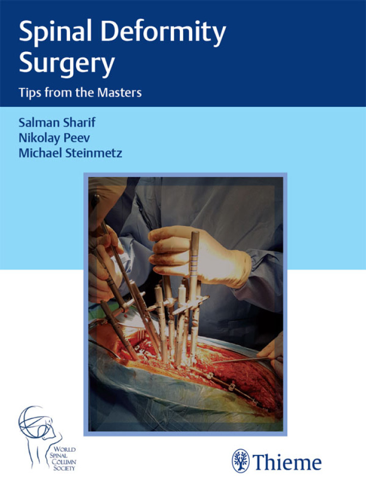 (eBook PDF)Spinal Deformity Surgery 1st Edition Tips from the Masters by Salman Sharif