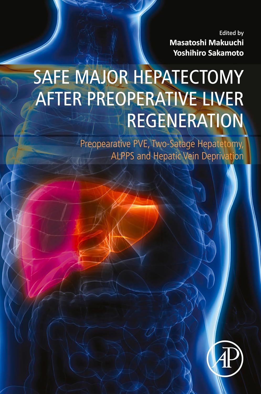 (EBook PDF)Safe Major Hepatectomy after Preoperative Liver Regeneration: Preopearative PVE, Two-Satage Hepatetomy, ALPPS and Hepatic Vein Deprivation by Yoshihiro Sakamoto , Masatoshi Makuuchi