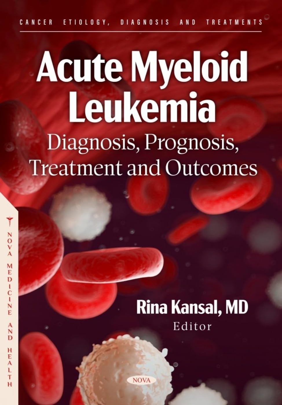 (EBook PDF)Acute Myeloid Leukemia: Diagnosis, Prognosis, Treatment and Outcomes by Ed. Kansal, Rina