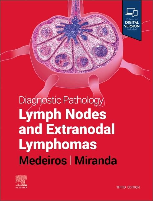 (EBook PDF)Diagnostic Pathology: Lymph Nodes and Extranodal Lymphomas 3rd by L. Jeffrey Medeiros MD, Roberto N. Miranda MD