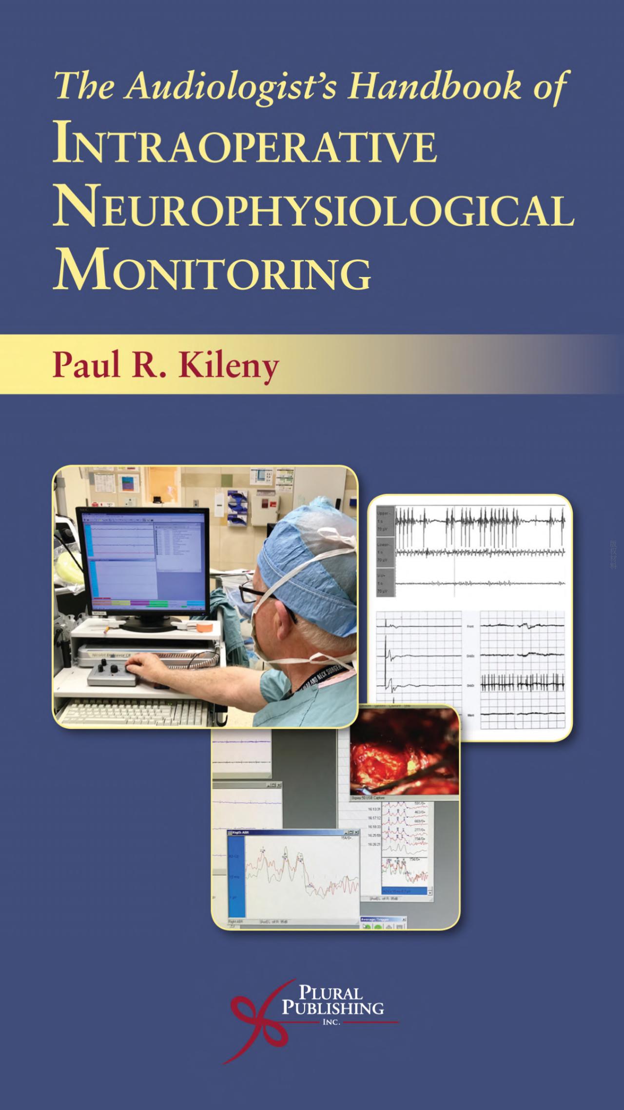 (eBook PDF) The Audiologist＆＃39;s Handbook of Intraoperative Neurophysiological Monitoring by Paul Kileny