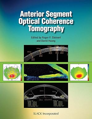 (eBook PDF)Anterior Segment Optical CoherenceTomography by Roger Steinert MD , David Huang MD PhD