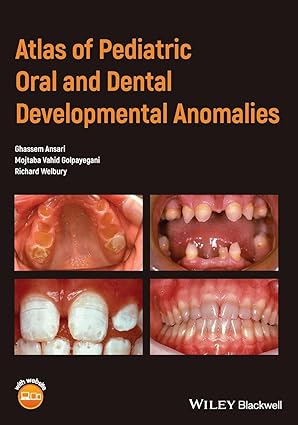 (eBook PDF)Atlas of Pediatric Oral and Dental DevelopmentalAn by Ghassem Ansari , Mojtaba Vahid Golpayegani , Richard Welbury