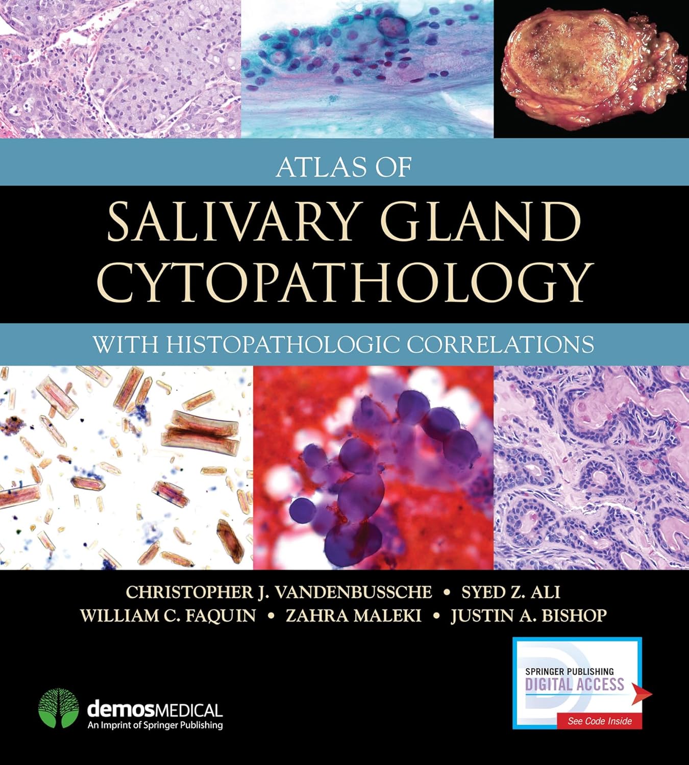 (eBook PDF)Atlas of Salivary Gland Cytopathology With Histopathologic Correlations by Christopher J. VandenBussche MD PhD , Syed Z. Ali MD FRCPath FIAC , William C. Faquin MD PhD , Zahra Maleki MD , Justin Bishop MD 