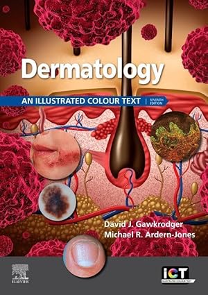 (eBook PDF)Dermatology E-Book An Illustrated Colour Text 7th by David Gawkrodger , Michael R. Ardern-Jones 