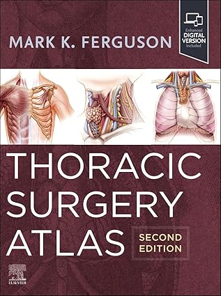  (eBook PDF)Thoracic Surgery Atlas 2nd Edition by Mark K. Ferguson MD