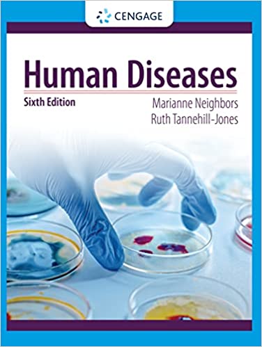 Test Bank for Human Diseases 6th Edition by Marianne Neighbors, Ruth Tannehill-Jones